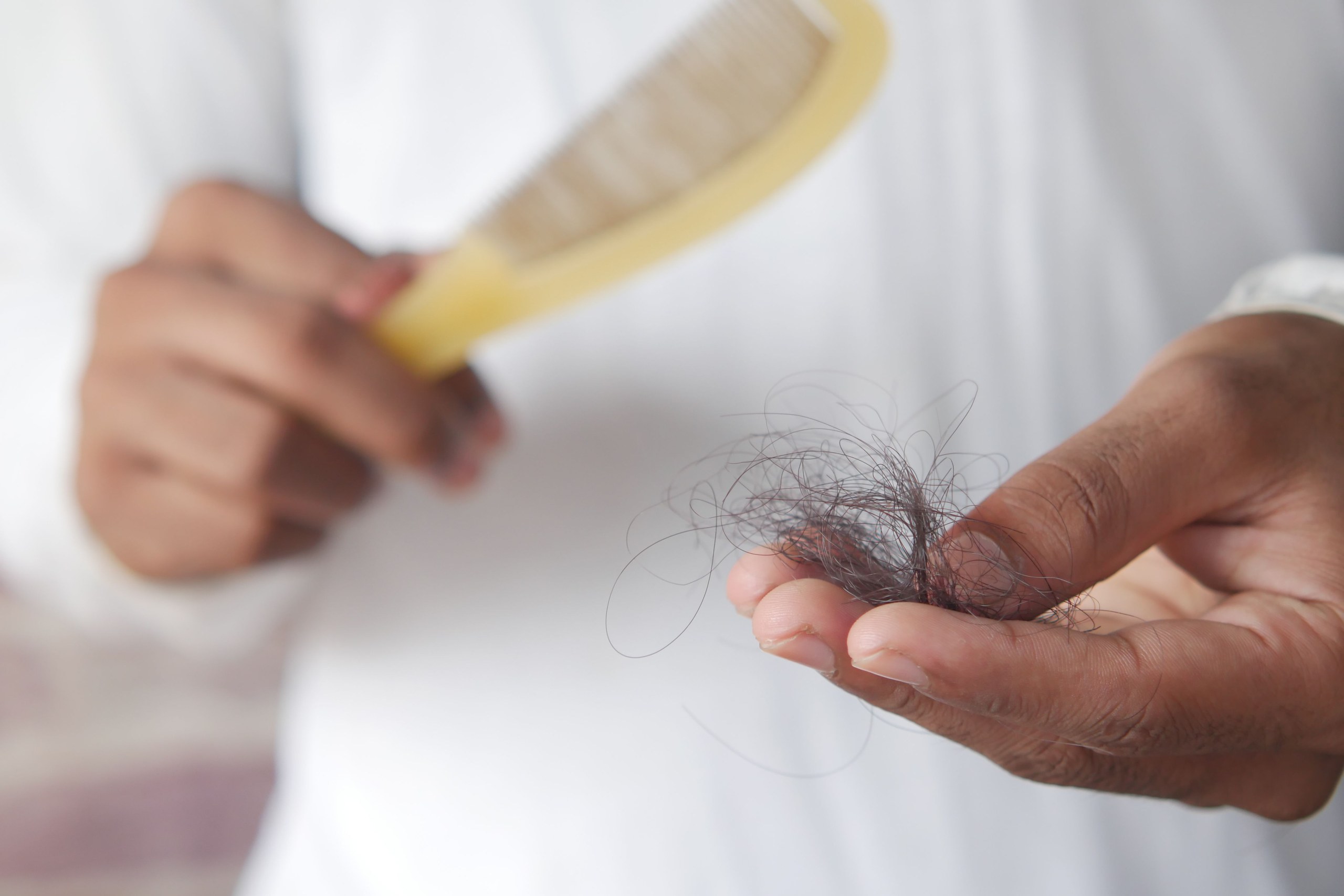 Does PRP Work for Hair Loss? The Truth Explained